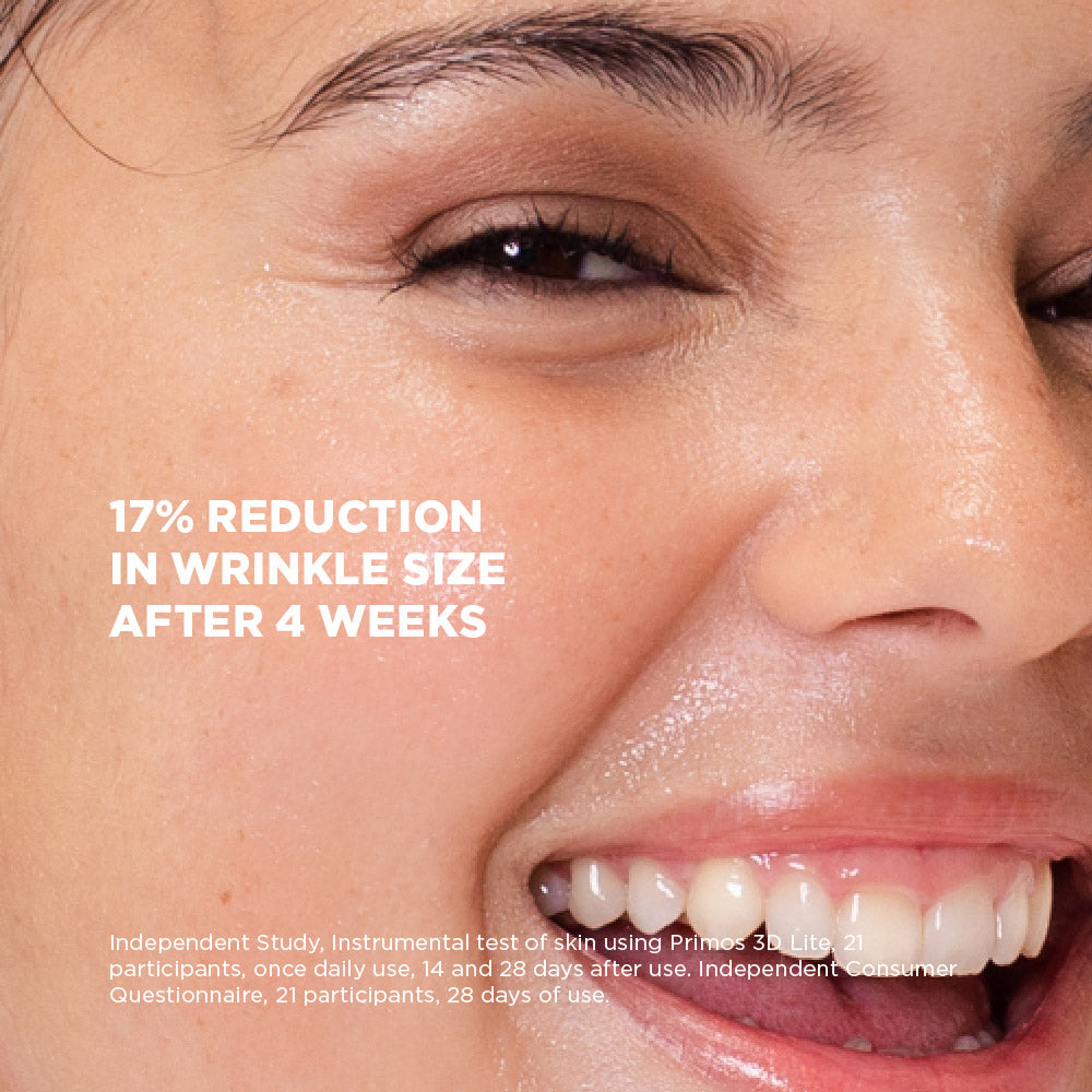 Close-up of a person's face with text about wrinkle reduction after 4 weeks.