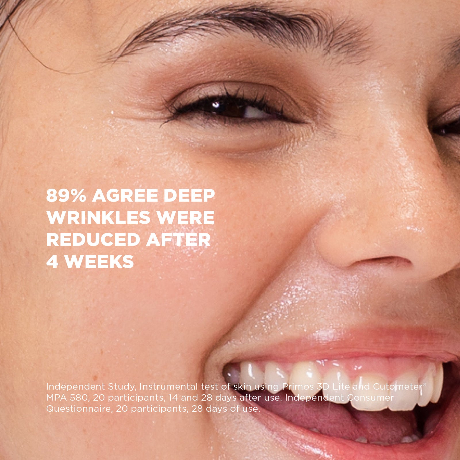 Close-up of a woman's face with text indicating deep wrinkles reduction after 4 weeks.
