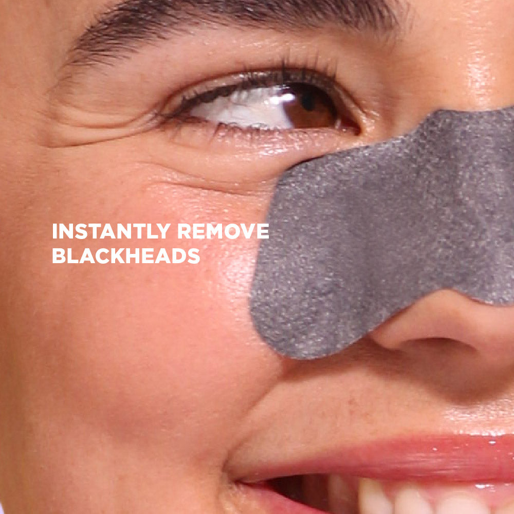 Charcoal Nose Strip (6 Nose Strips)