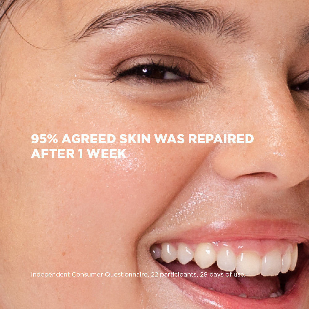 Close-up of a person's face with a smile, showing skin repair after a week of use.