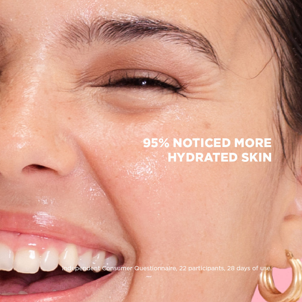 Close-up of a woman's face with moisturizer applied, showing hydrated skin.