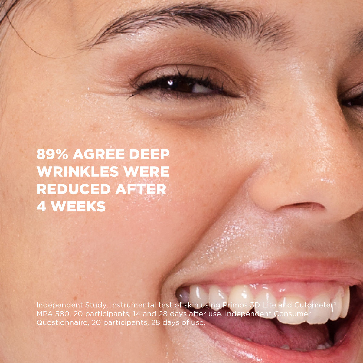 Close-up of a woman's face with text indicating deep wrinkles reduction after 4 weeks.