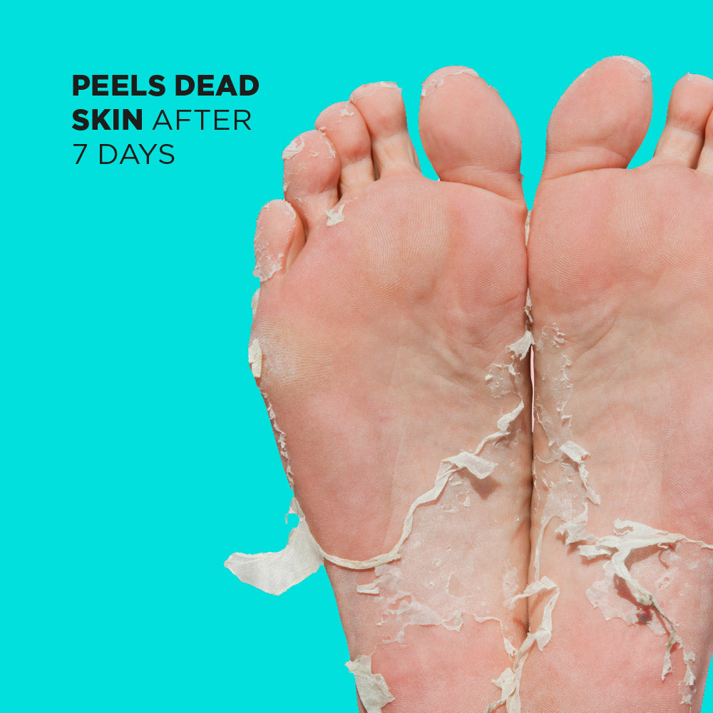 Biodegradable Foot Peel